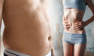 obesidade x desnutrição