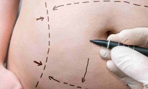 cirurgia reparadora