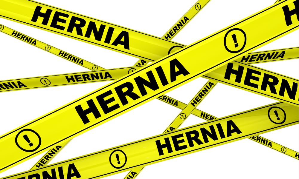 Descubra aqui as causas das hérnias abdominais