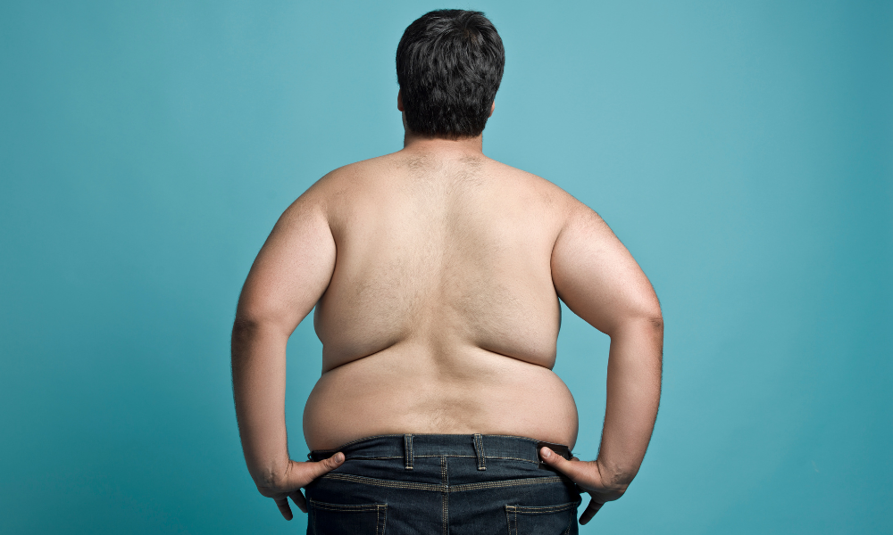 Os desafios da obesidade